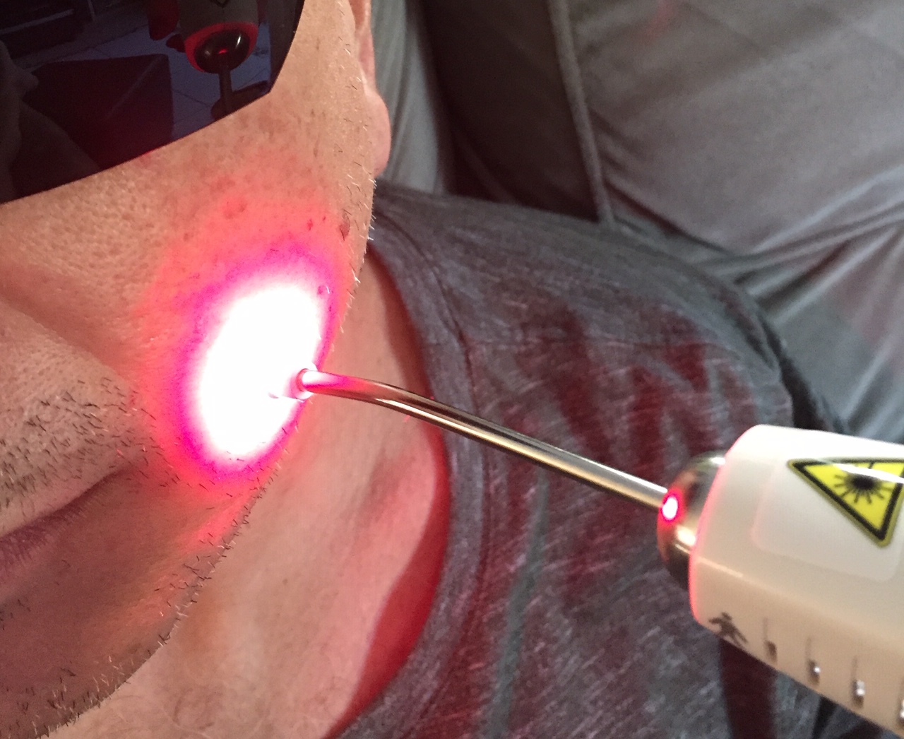 You are currently viewing 3 Tipos de Terapia com Laser não cortante  na Otorrinolaringologia